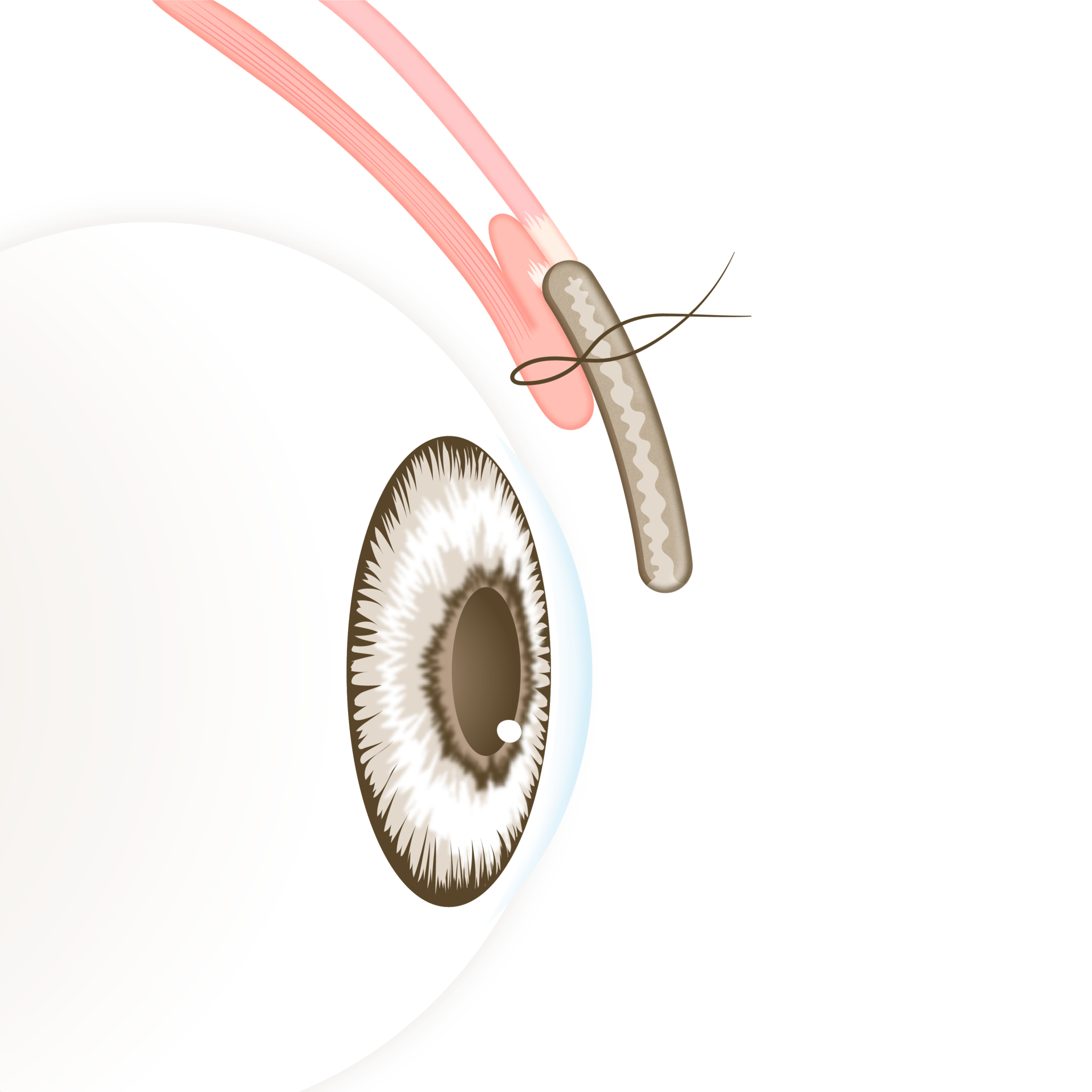 <p style="text-align: center;"><span style="font-size: 14px;">근육의 길이가 짧아짐</span></p>