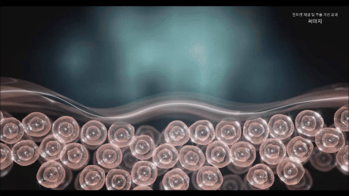 매 샷 자동 임피던스 매칭