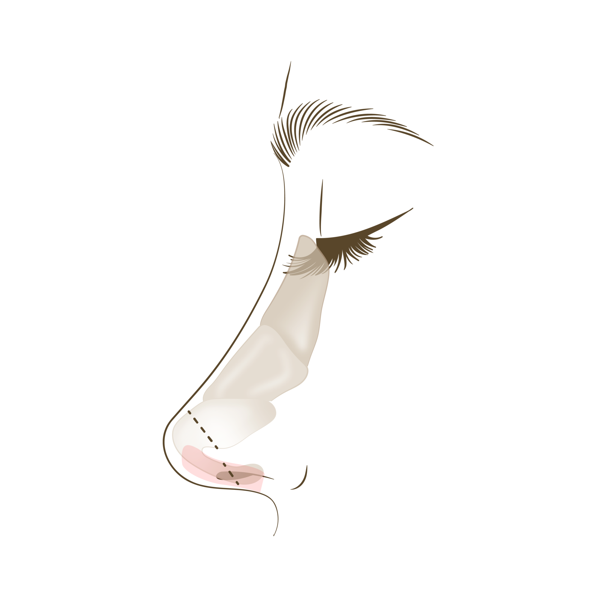 <p style="text-align: center;"><span style="font-size: 14px;">코 연골을 위로 고정</span></p>