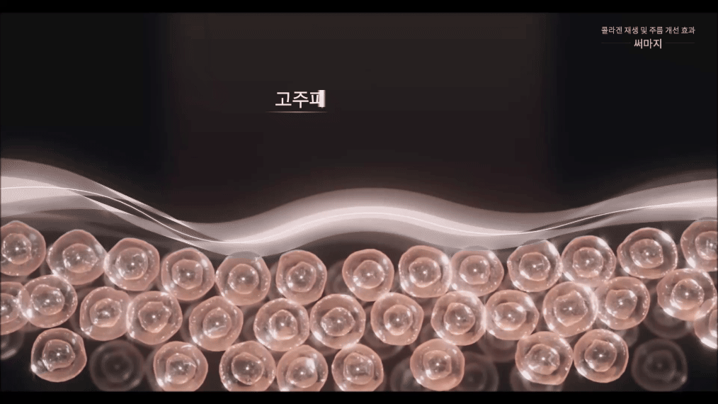 고주파 에너지 전달