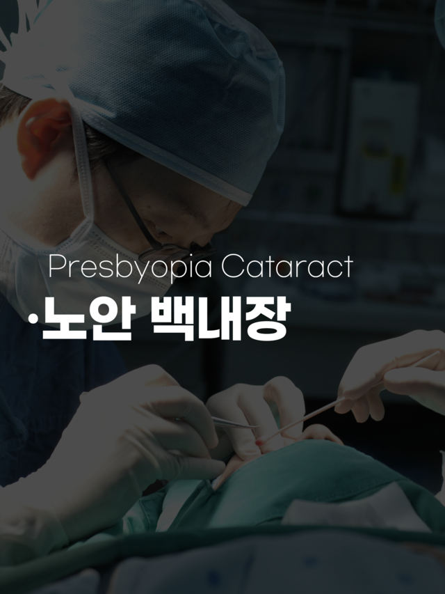 노안백내장