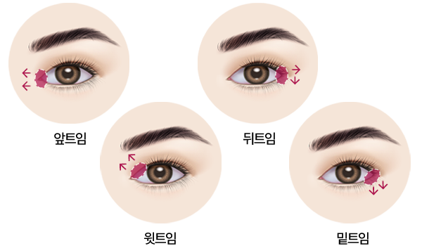 앞, 뒤, 윗, 밑 위치에 따른 트임 예시