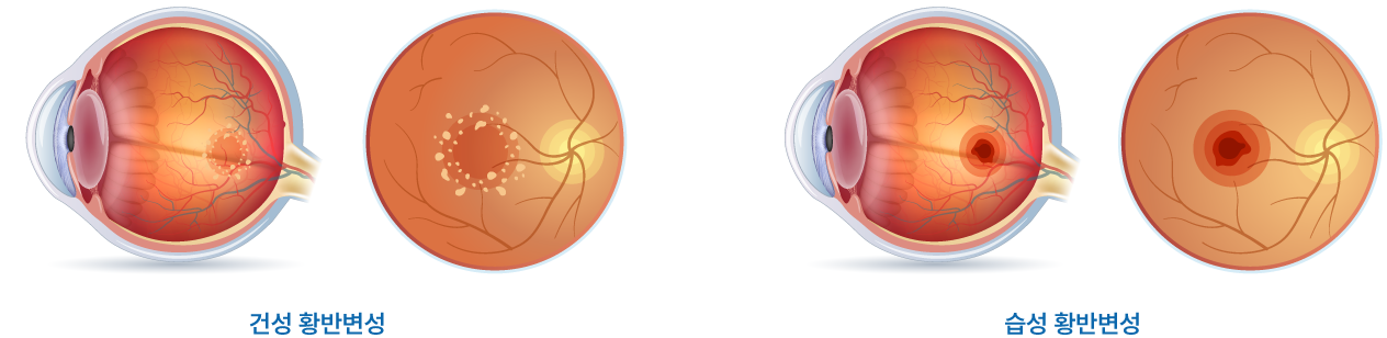 retina_eyes02