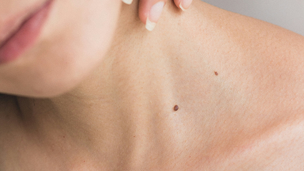 목 주위에 점이 있는 모습