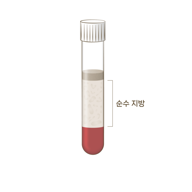 순수 지방 분리 <br>