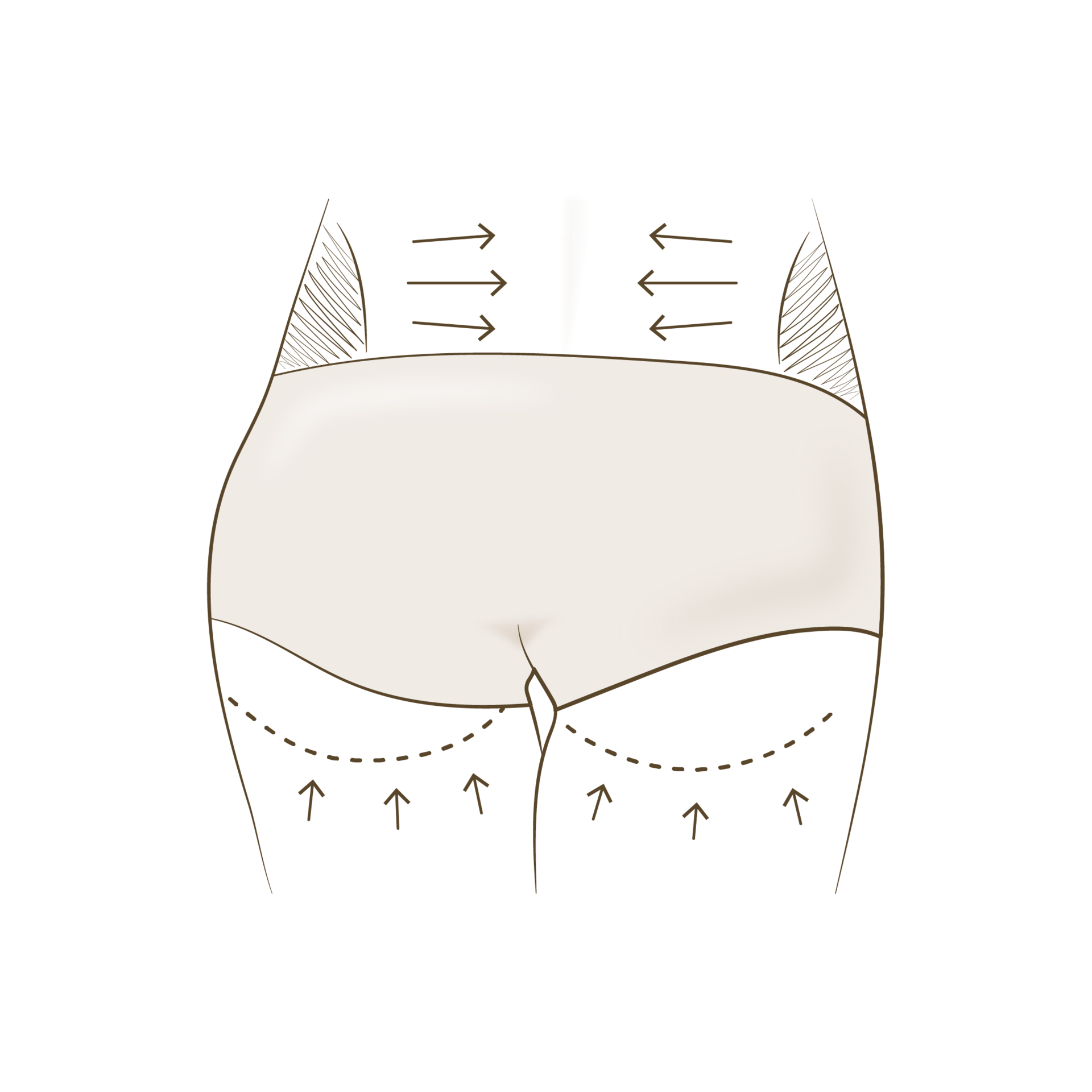 <p style="text-align: center;"><span style="font-size: 14px;">수술 전</span></p>