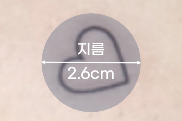 500원 동전 사이즈 문신제거