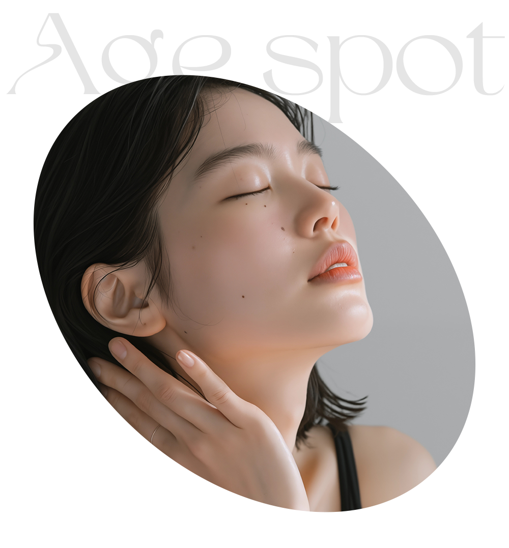 Agespot을 표현한 이미지