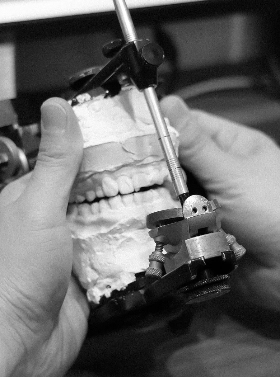 은계지구-클리어치과-일반진료센터-크라운치료