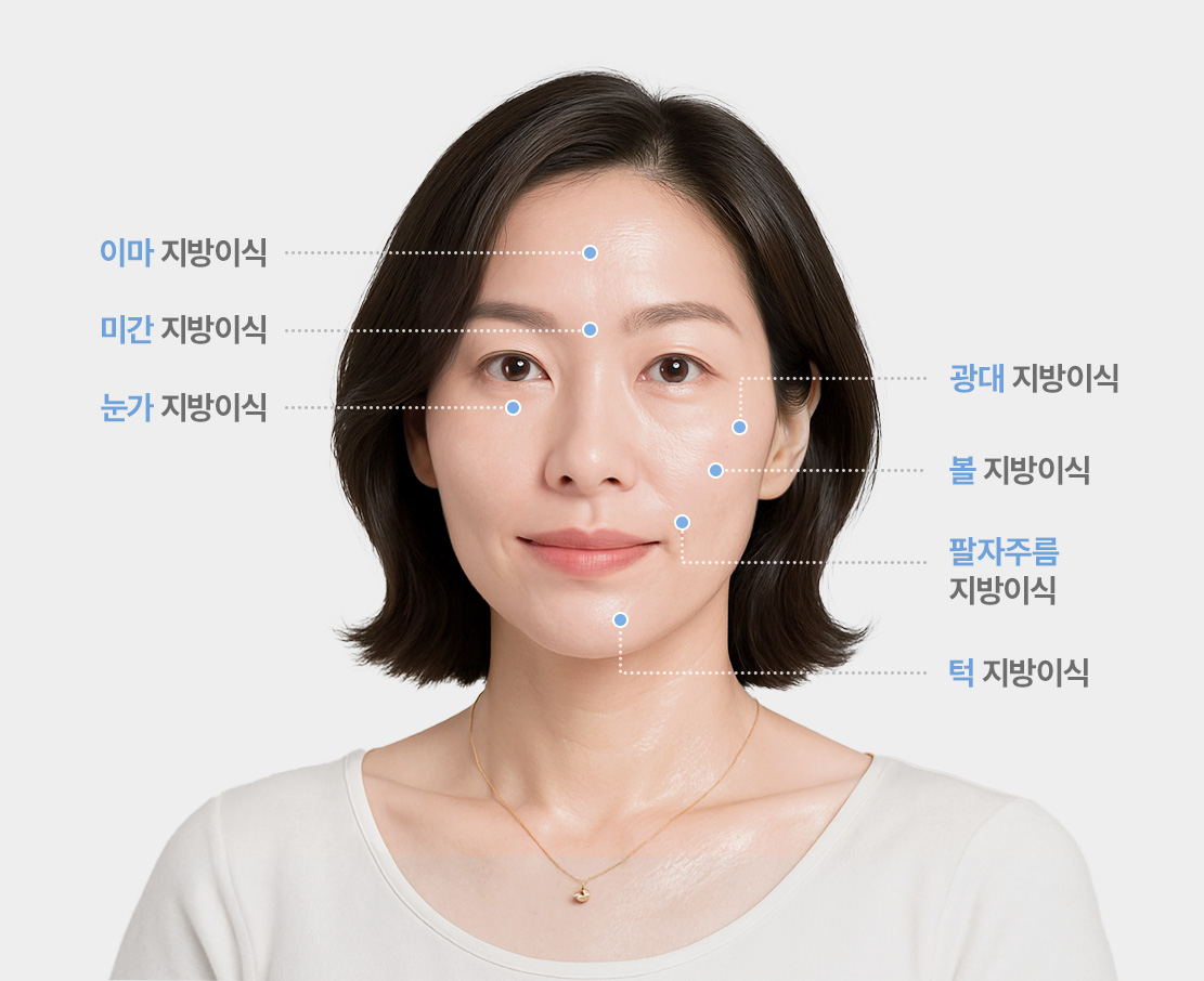 리드성형외과-지방이식-이마지방이식-미간지방이식-눈가지방이식-광대지방이식-볼지방이식-팔자주름지방이식-턱지방이식