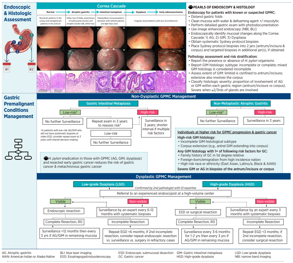 ACG Clinical Guideline: Diagnosis and Management of Gastric ...