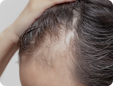 <p style="text-align: center;"> 	<br> </p>  <p style="text-align: center;"><span style="font-size: 24px; color: rgb(255, 255, 255);">因自信心下降，</span></p>  <p style="text-align: center;"><span style="font-size: 24px; color: rgb(255, 255, 255);">連戀愛或社交都變得退縮</span></p>  <p style="text-align: center;"> 	<br> </p>