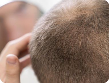 <p style="text-align: center;"> 	<br> </p>  <p style="text-align: center;"><span style="font-size: 24px; color: rgb(255, 255, 255);">髮量變少，</span></p>  <p style="text-align: center;"><span style="font-size: 24px; color: rgb(255, 255, 255);">讓人看起來比實際年齡更老</span></p>  <p style="text-align: center;"> 	<br> </p>