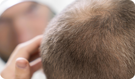 <p style="text-align: center;"> 	<br> </p>  <p style="text-align: center;"><span style="font-size: 20px; color: rgb(255, 255, 255);">髮量變少，</span></p>  <p style="text-align: center;"><span style="font-size: 20px; color: rgb(255, 255, 255);">讓人看起來比實際年齡更老</span></p>  <p style="text-align: center;"> 	<br> </p>