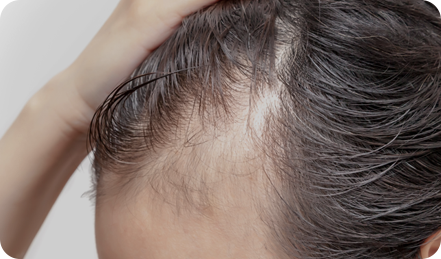 <p style="text-align: center;"> 	<br> </p>  <p style="text-align: center;"><span style="font-size: 20px; color: rgb(255, 255, 255);">因自信心下降，</span></p>  <p style="text-align: center;"><span style="font-size: 20px; color: rgb(255, 255, 255);">連戀愛或社交都變得退縮</span></p>  <p style="text-align: center;"> 	<br> </p>