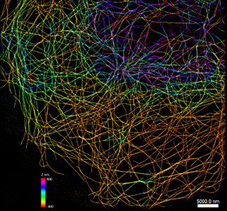 Super-resolution image of microtubules with B-TIRF. Image credit: F. Rivera-Molina,  Yale University.
