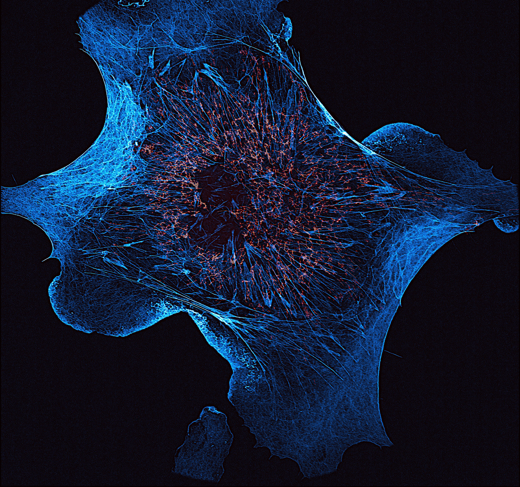 “SRRF” super-resolution image taken with the Sona back- illuminated sCMOS camera, Andor Insight Awards, courtesy of Motosuke Tsutsumi, Research Institute for Electronic Science, Hokkaido University and National Institutes for Physiological Sciences, Aichi, Japan.
