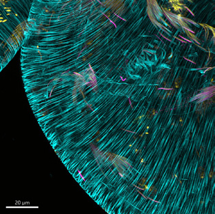 Drosophila testes showing different stages of  sperm  individualization  (fixed  tissue, IHC). Yellow: DAPI, Purple: protamine-GFP, Blue: phalloidin (actin).