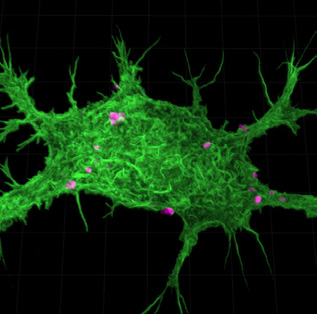 Murine Macrophage stained with AlexaFluor488 Phalloidin phagocytosing E.coli bioparticles labelled Alexa fluor 594. Captured at 100x magnification.
