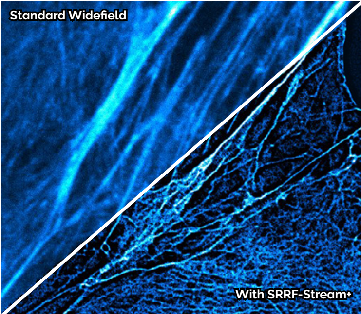 SRRF-Stream image of alpha-tubulin (red) and cell nuclei (cyan). Image credit Motosuke Tsutsumi National Institute for  Physiological Science, Japan.