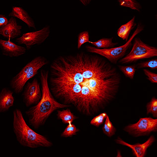 SRRF-Stream image of alpha-tubulin (red) and cell nuclei (cyan). Image credit  Motosuke Tsutsumi National Institute for Physiological Science, Japan.