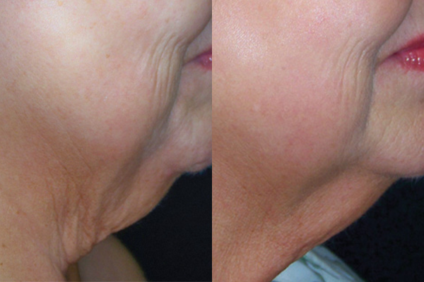 <p><span style="font-size: 12px;">BEFORE → AFTER</span> </p>