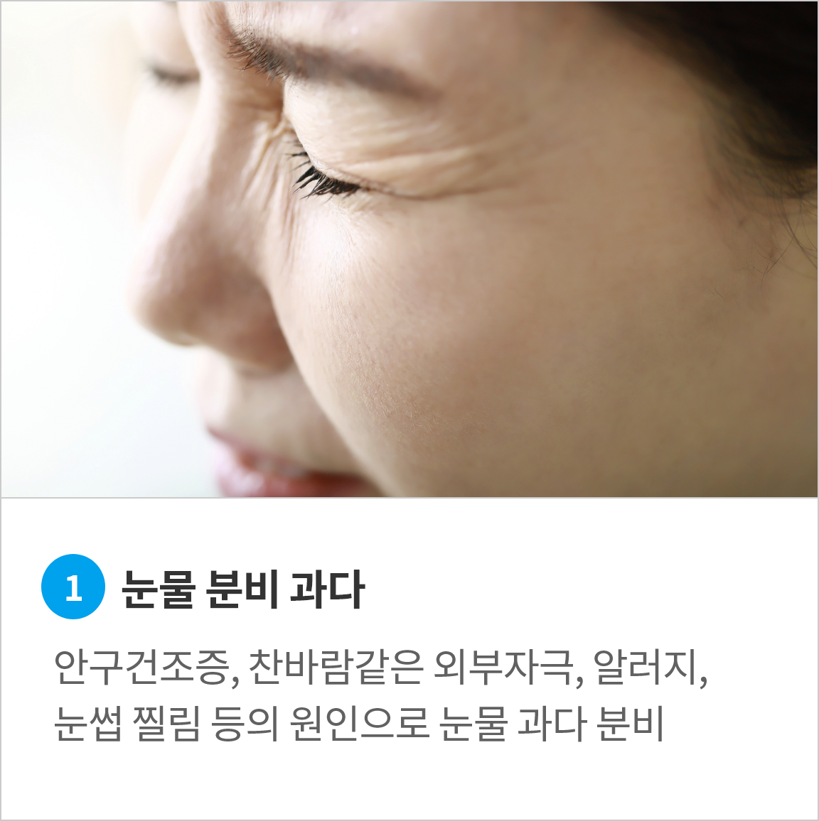 <alt=눈물관다분비>