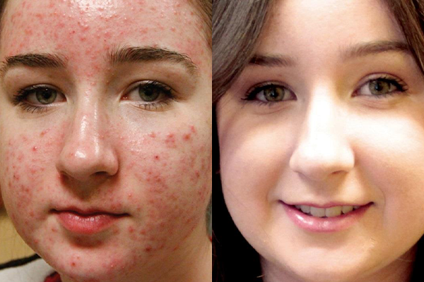 <p><span style="font-size: 12px;">BEFORE → AFTER</span> </p>