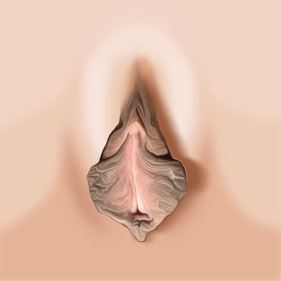 Wrinkles and<br>Hypertrophy