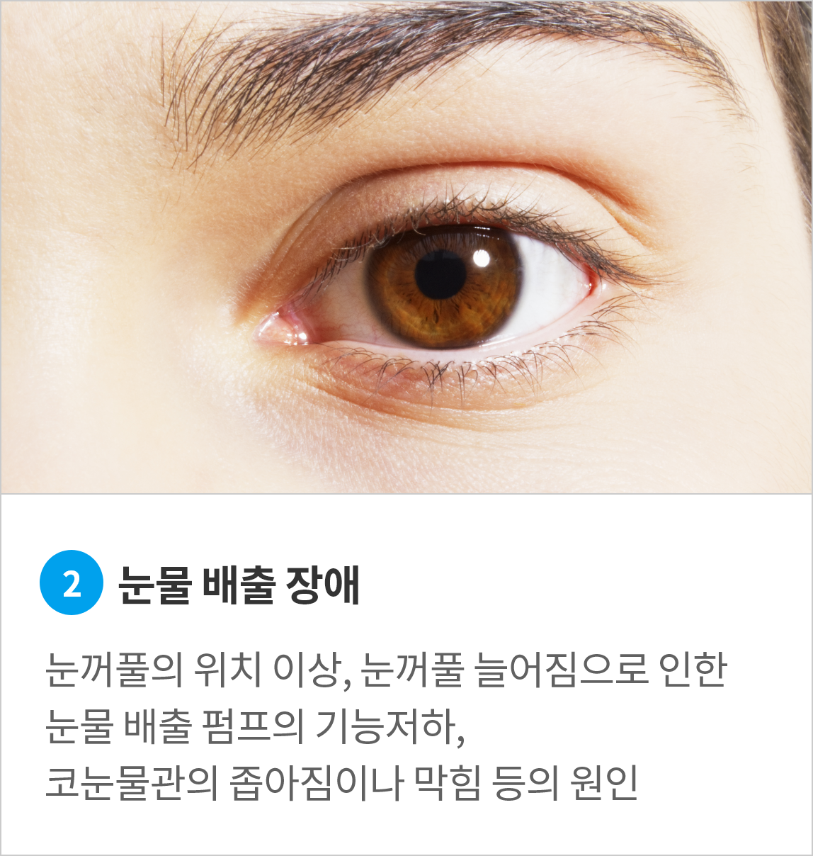 <alt=눈물배출감소>
