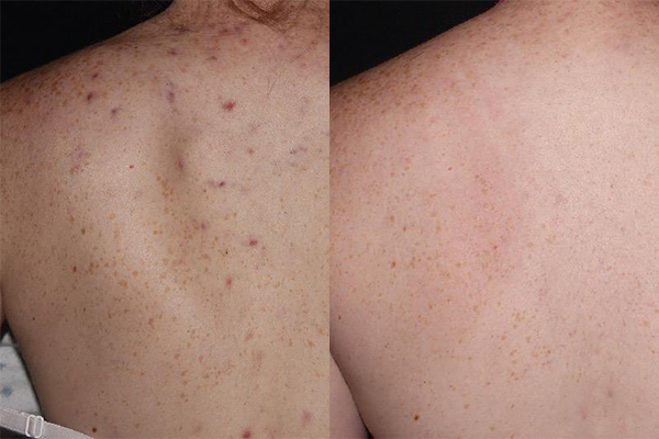 <p><span style="font-size: 12px;">BEFORE → AFTER</span> </p>