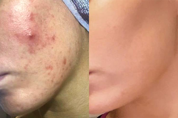 BEFORE → AFTER