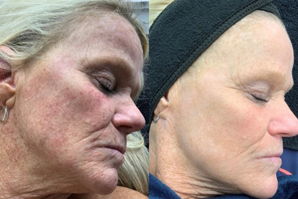 <p><span style="font-size: 12px;">BEFORE → AFTER</span> </p>