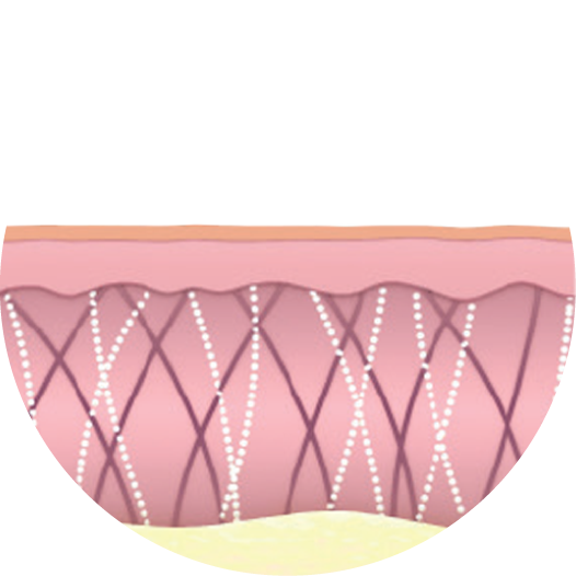 <strong><span style="font-size: 20px;">LATER</span></strong><br><span style="font-size: 14px;">Regeneration and reconstruction of collagen and elastin fibers</span></span>