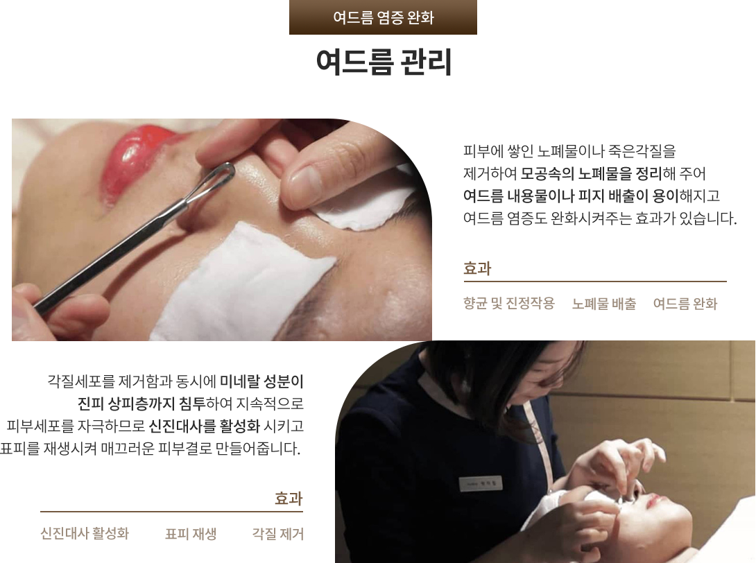 여드름관리