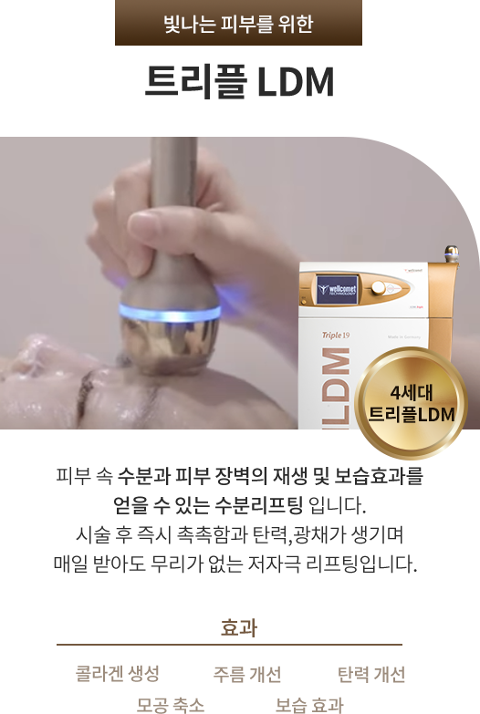 트리플 LDM