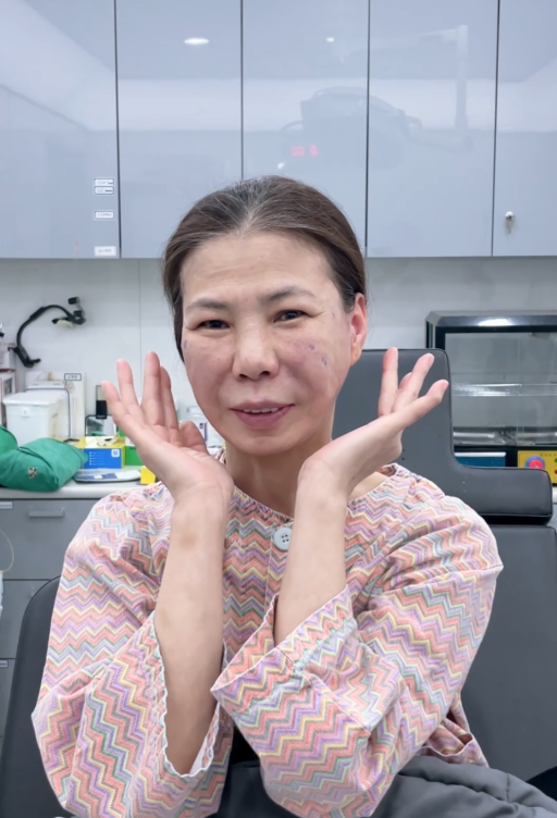 설OO 선생님 어머니     줄기세포  시술