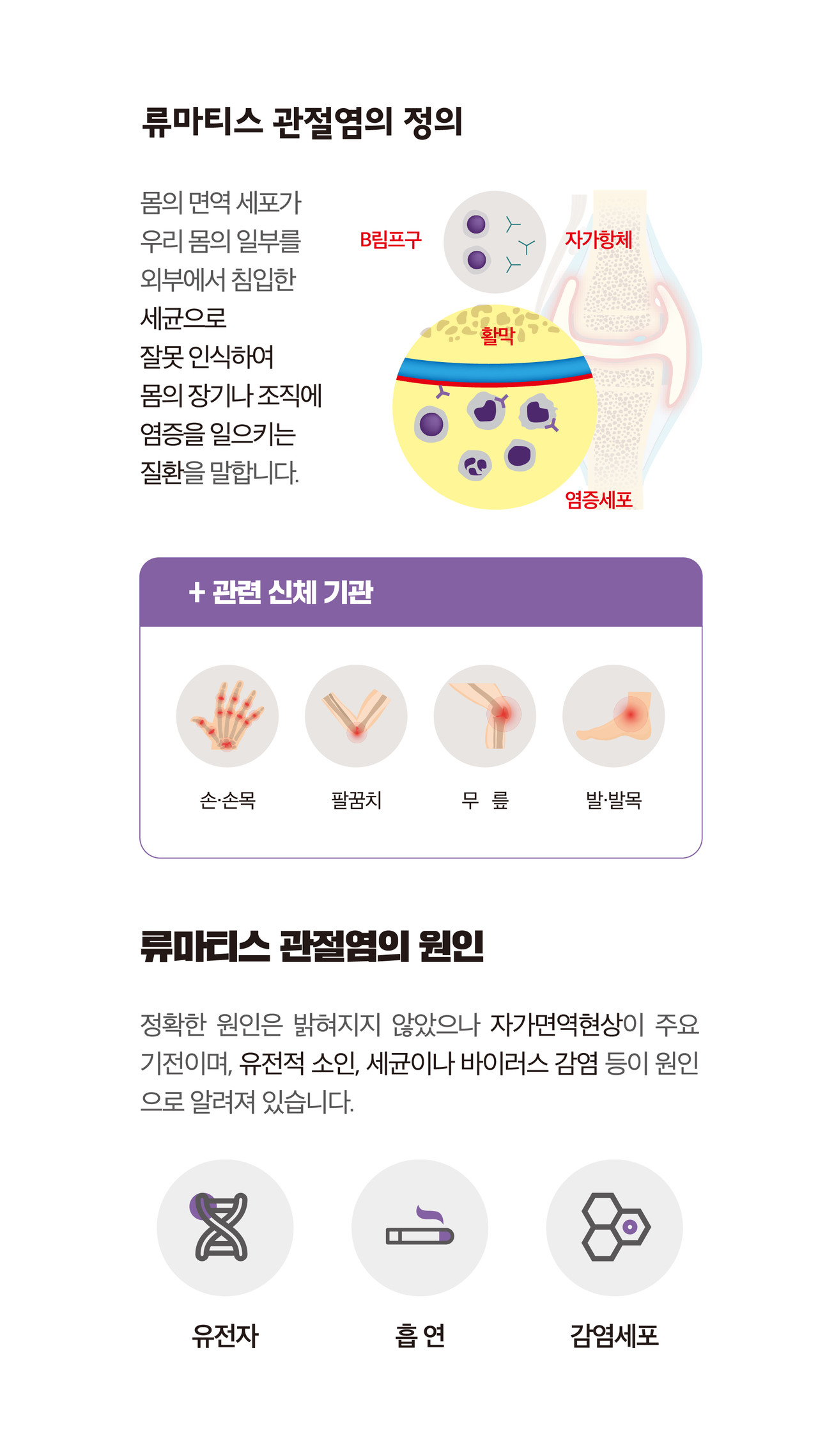 류마티스 관절염의 원인