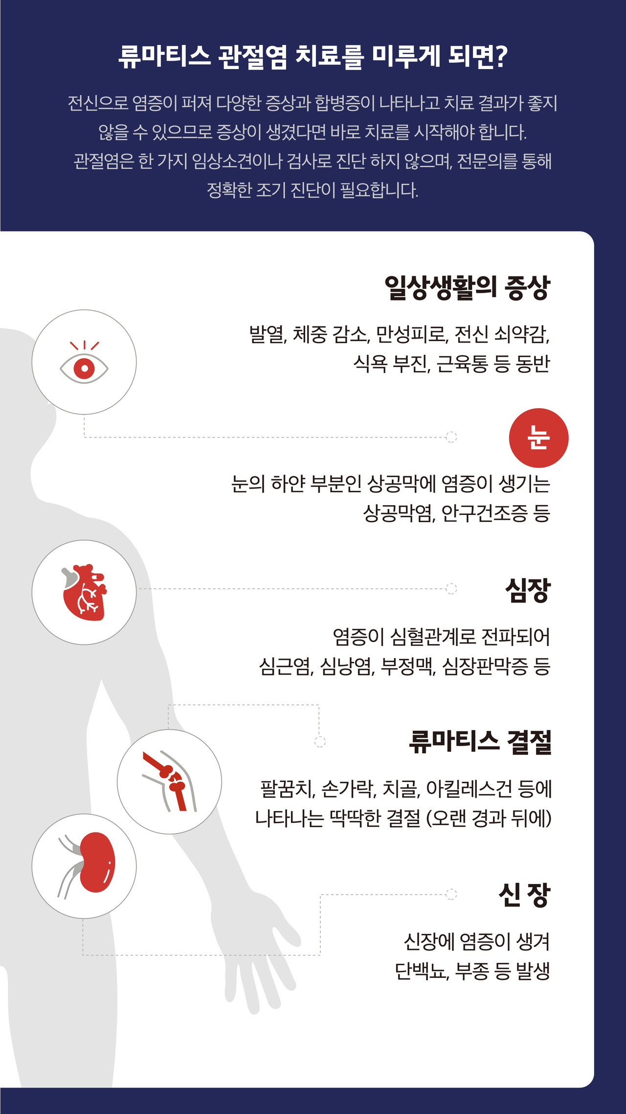 류마티스관절염 쇠약감 상공막염 안구건조증 심근염 심낭염 부정맥 심장판막증 류마티스결절 단백뇨 신장부종 
