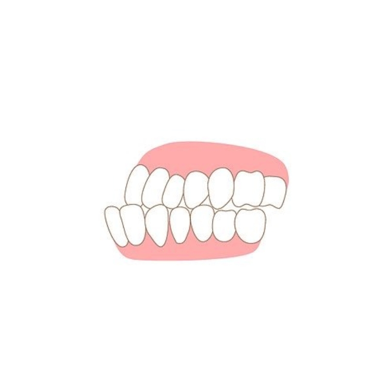 <p style="margin-left:10px;"></p><h5 style="margin-left:10px">주걱턱</h5>