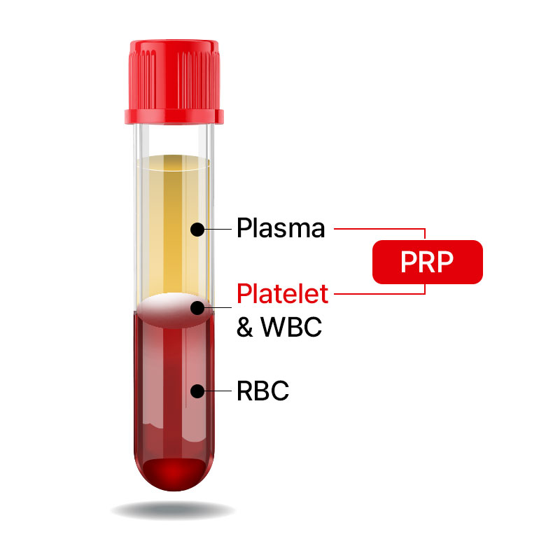 After centrifugation