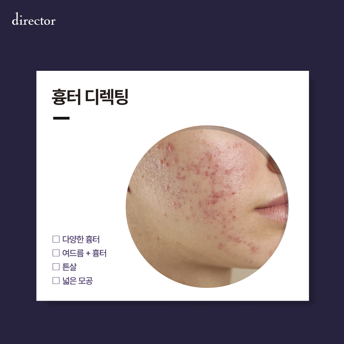 디렉터 흉터·모공·여드름 솔루션 | 피부 장벽과 흐름을 고려한 맞춤 치료 설계