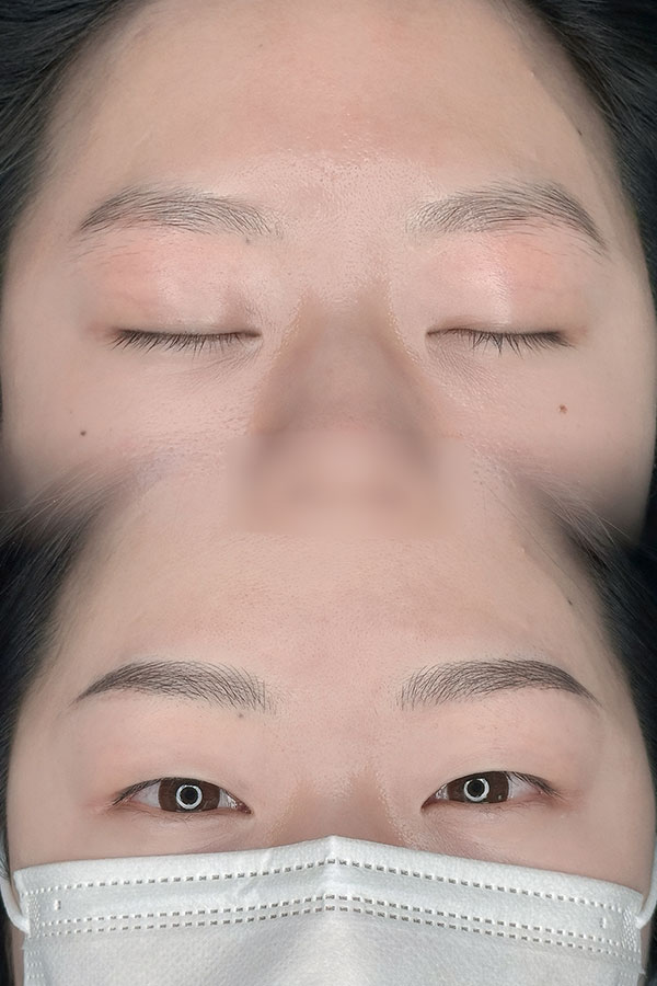 왁싱 교육생 임ㅇㅇ