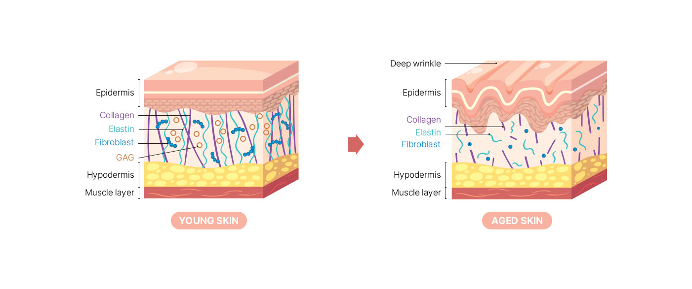 피부노화의 원인, ECM감소는 재생능력저하와 주름형성을 촉발합니다. 