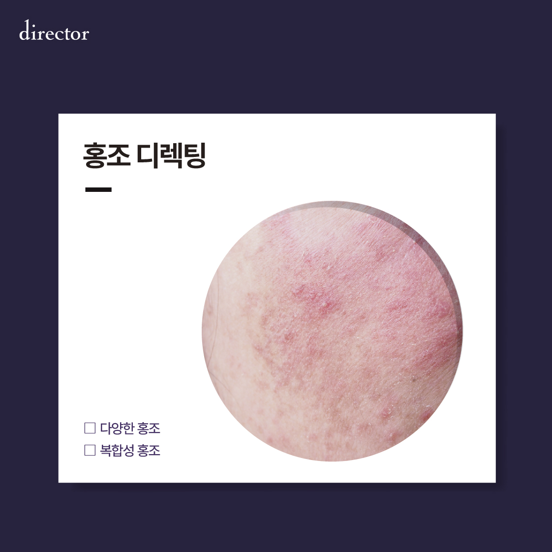 홍조디렉팅