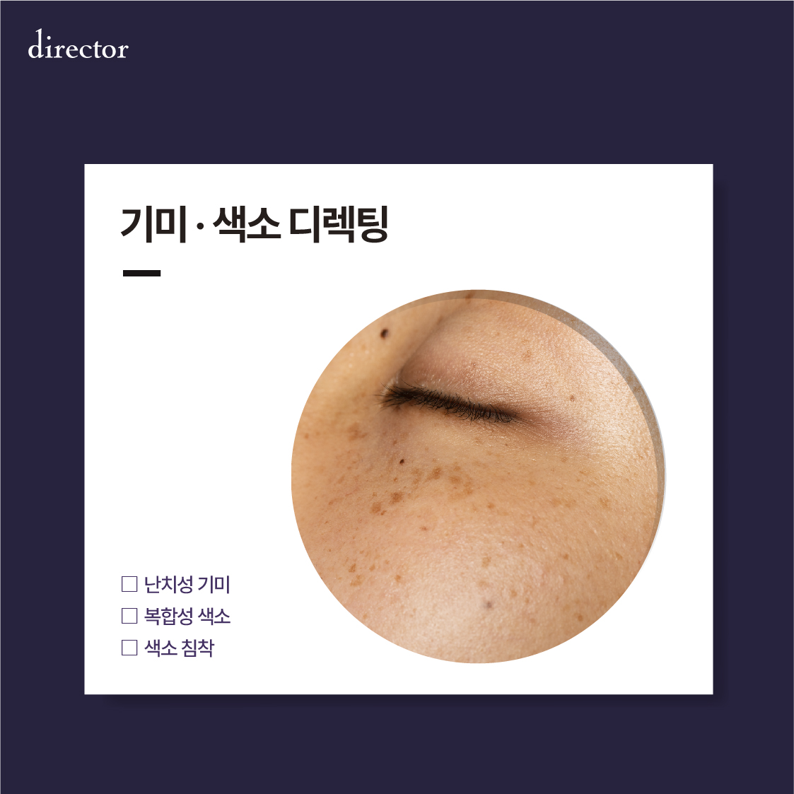 기미색소디렉팅