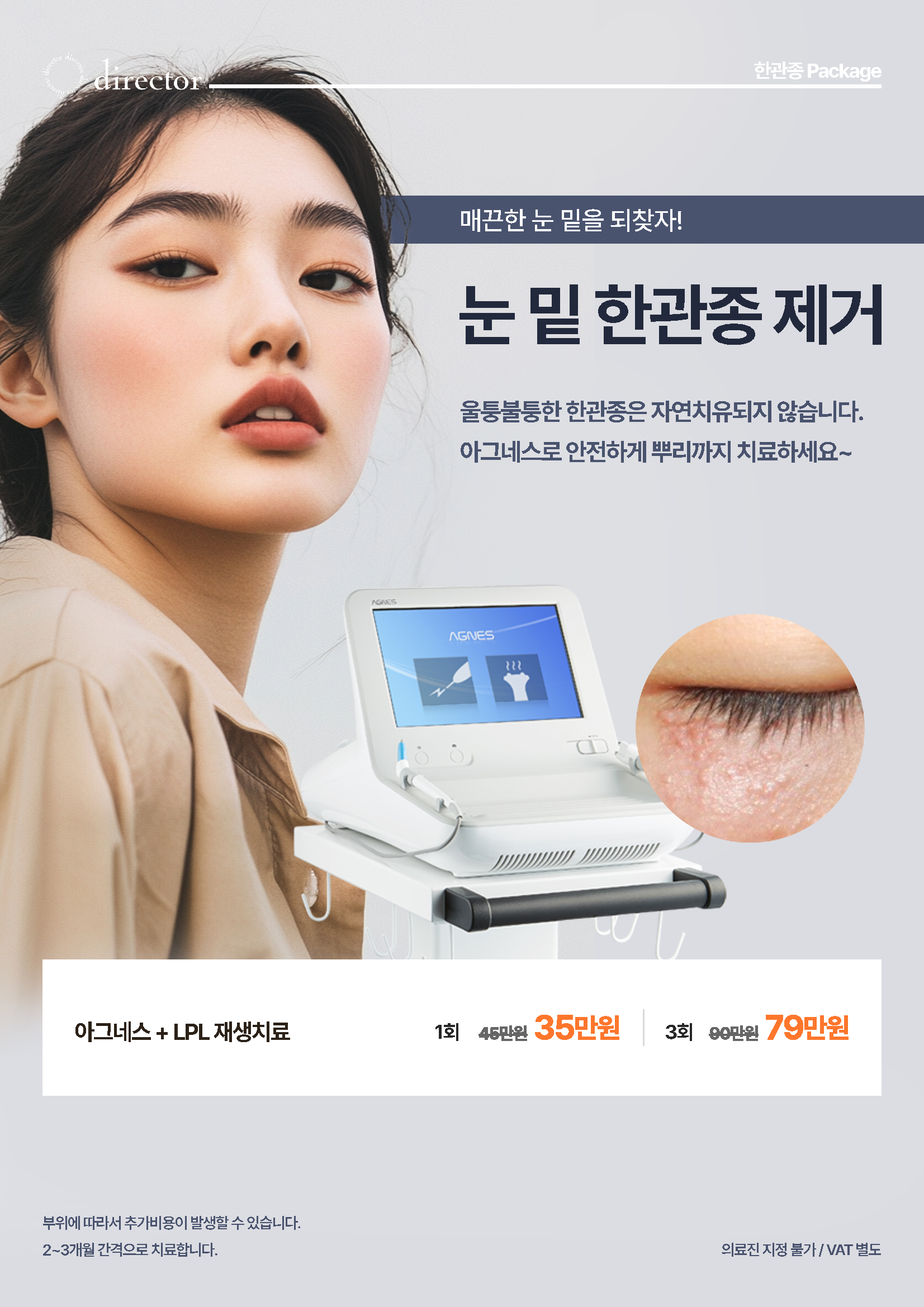 울퉁불퉁 눈 밑 한관종, 단순 제거보다 중요한 건 뿌리까지 안전하게 치료하는 것