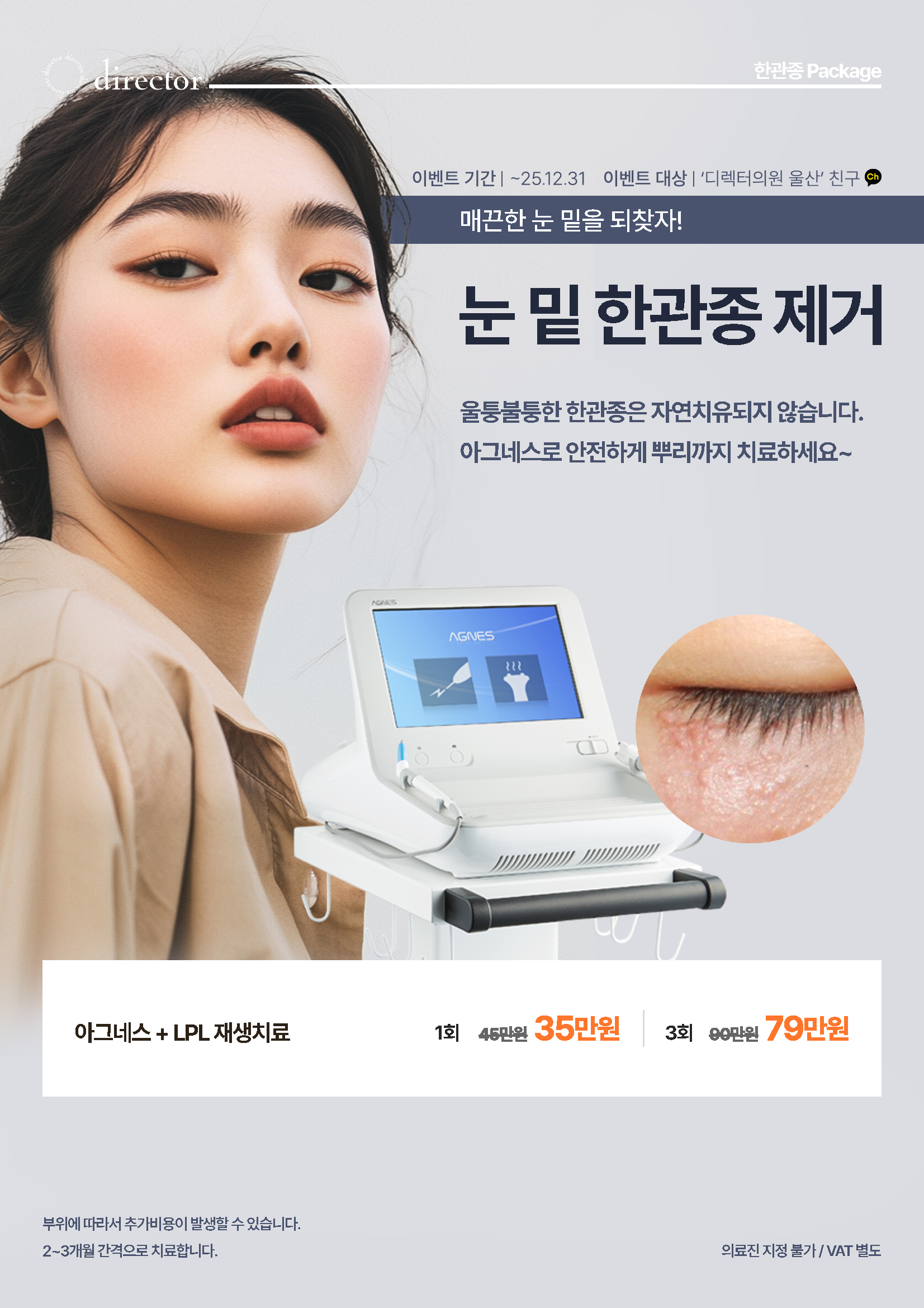 한관종 치료 – 아그네스와 LPL로 뿌리까지 집중 케어하는 안전한 눈가 시술