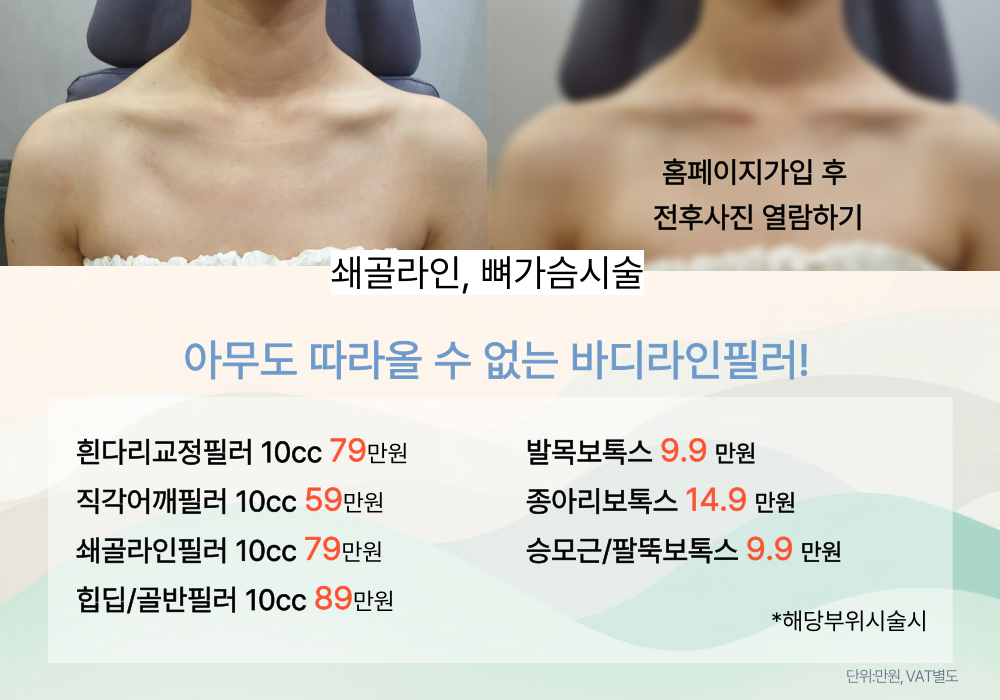 바디라인필러시술 역시 원더스! 전국에서 찾아오는 프리미엄 바디라인시술 