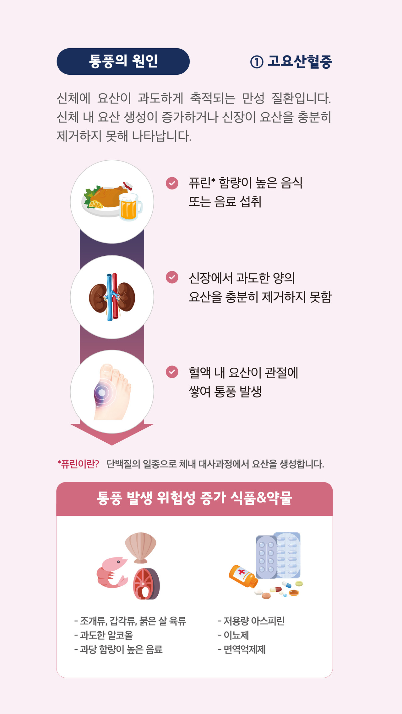퓨린 고요산혈증 통풍 조개류 갑각류 맥주 이뇨제 면역억제제